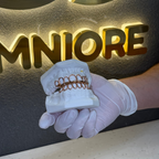 Window Set Grillz